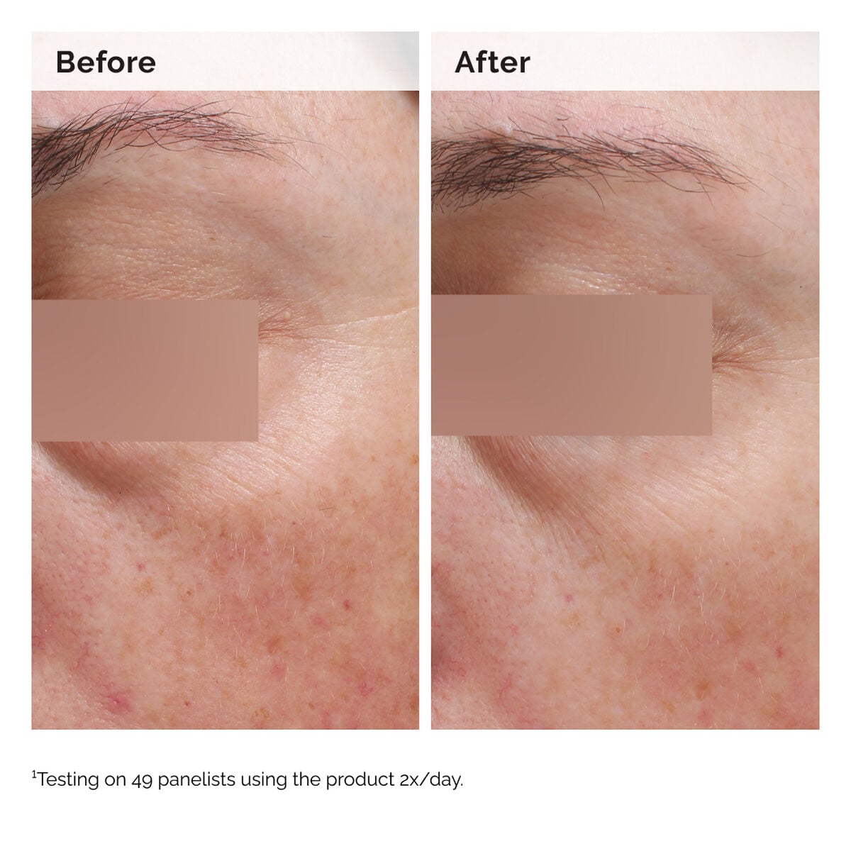 niacinamide-5-face-and-body-emulsion-o4 2024-08-23-ORD-Nia-5pct-Face-Body-B-A-Elasticity-Global-02-1x1.jpg
