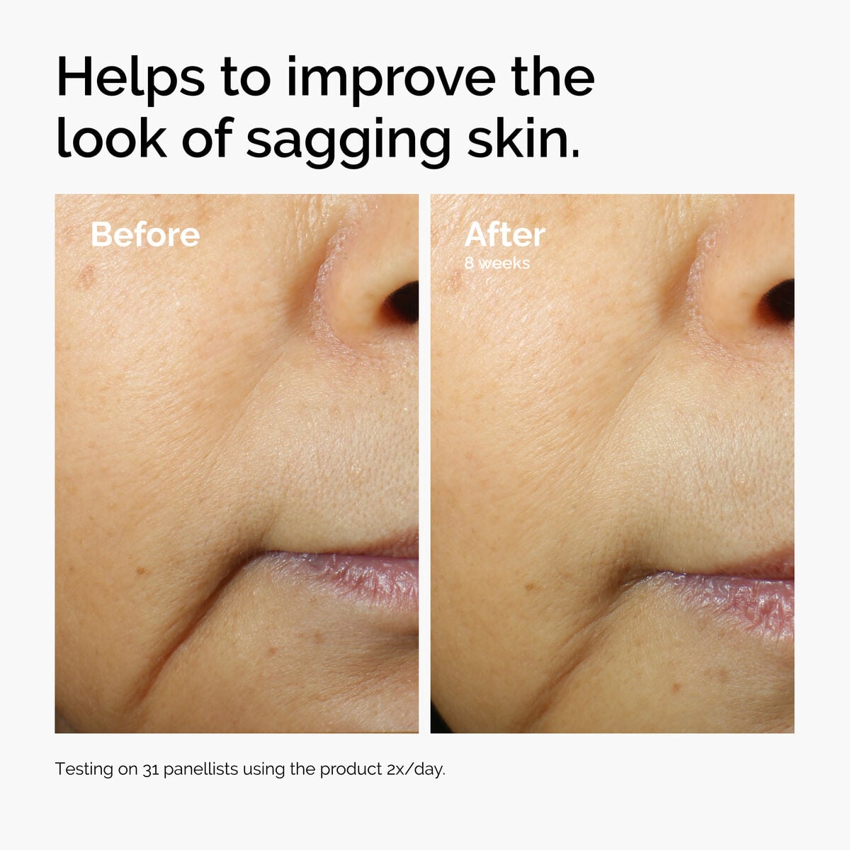 caffeine-3-escin-1-face-serum-c6 ord-caffeine-3pct-escin-1pct-face-serum-before-after-sagging.jpg