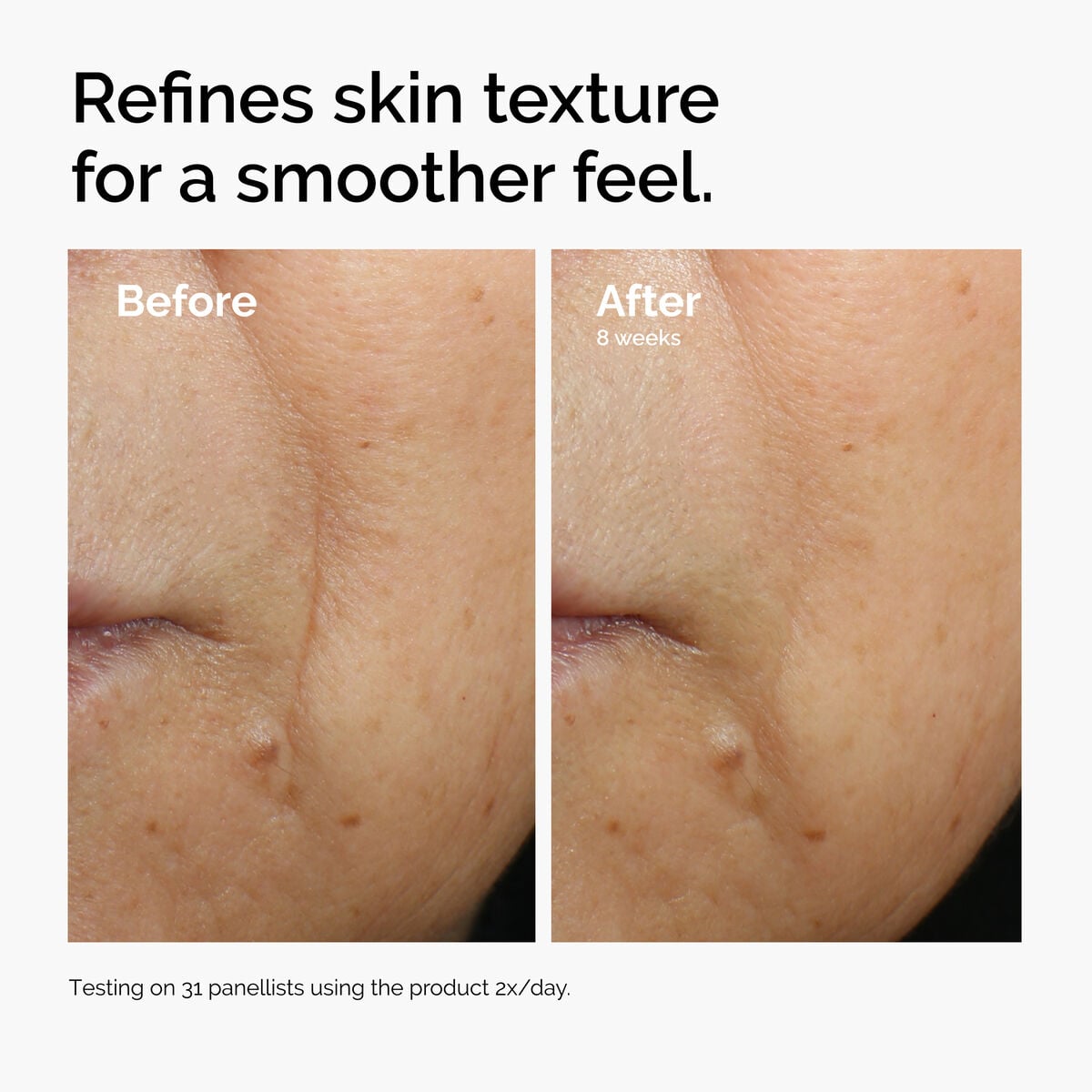 caffeine-3-escin-1-face-serum-c6 ord-caffeine-3pct-escin-1pct-face-serum-before-after-texture.jpg