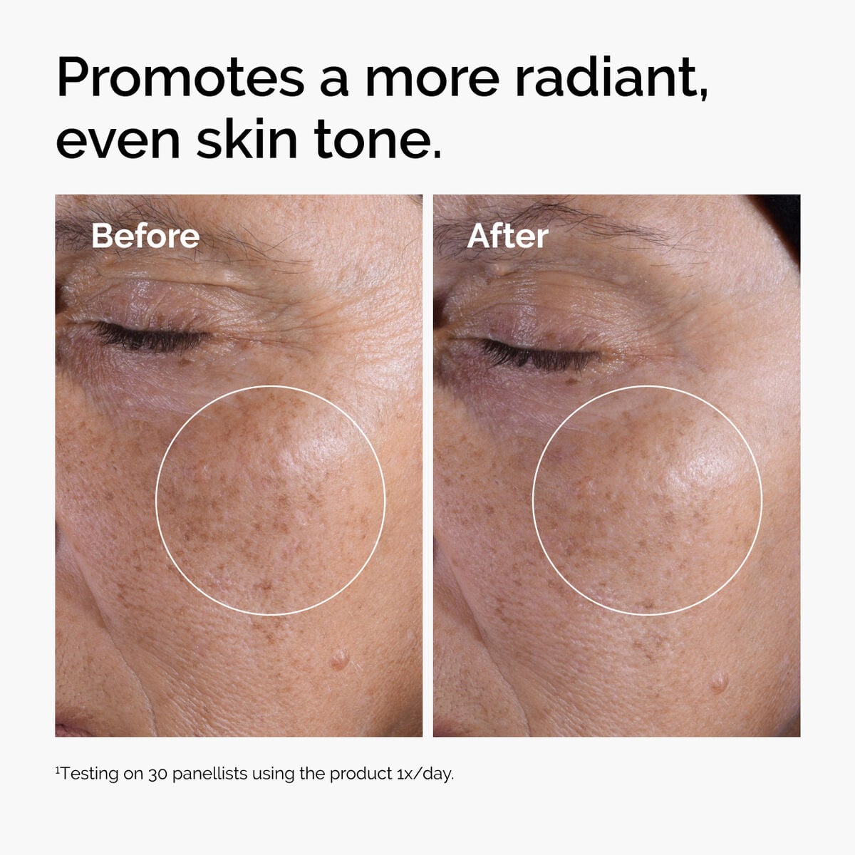 glycolic-acid-7-exfoliating-toner-b3 ord-glycolic-before-after-radiance.jpg