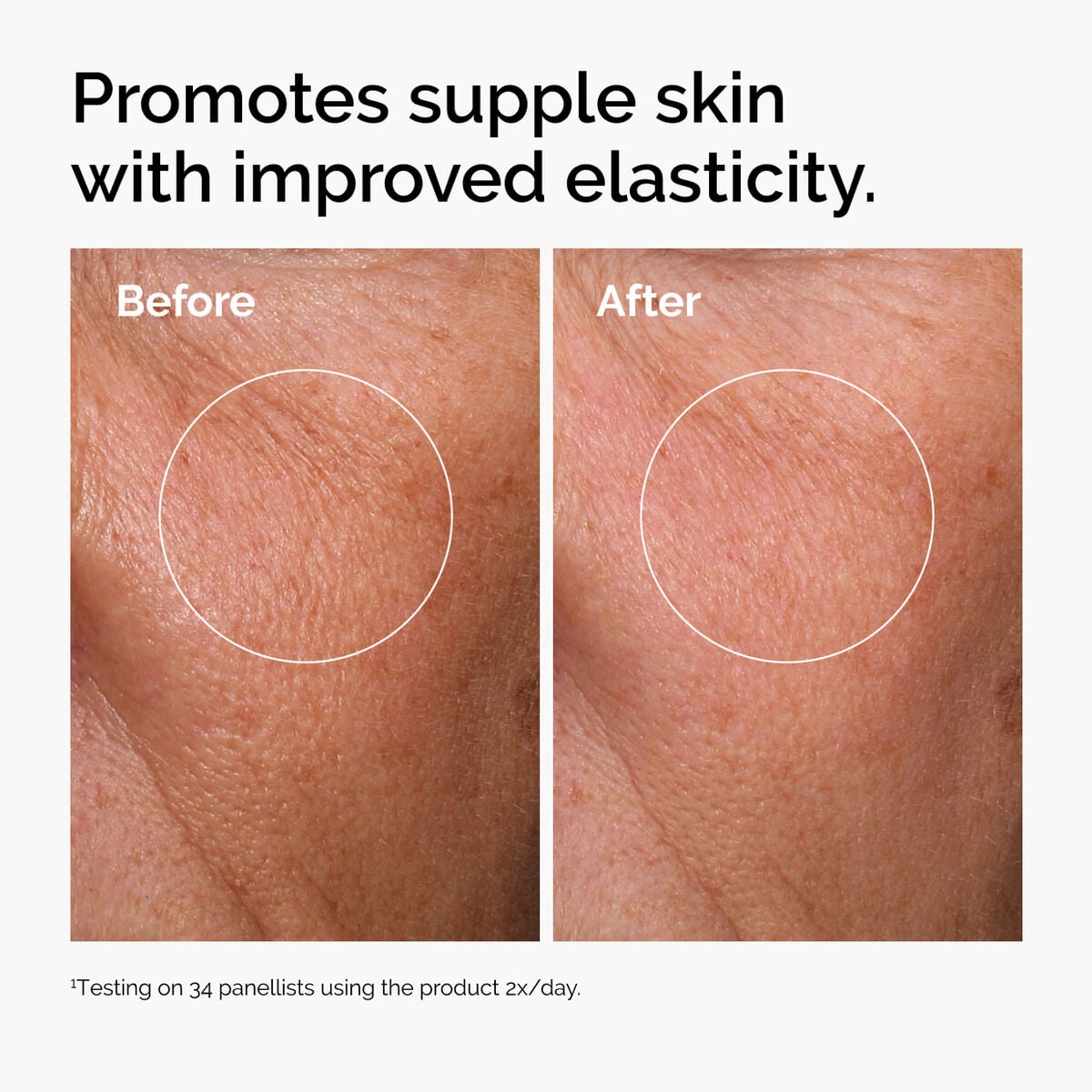 hyaluronic-acid-2-b5-with-ceramides-j9 ord-hyaluronic-acid-2pct-b5-hydrating-serum-before-after-elasticity.jpg