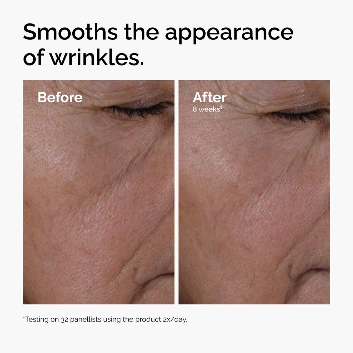 multi-peptide-ha-serum-w2 ord-multi-peptide-ha-serum-wrinkles-before-after.jpg