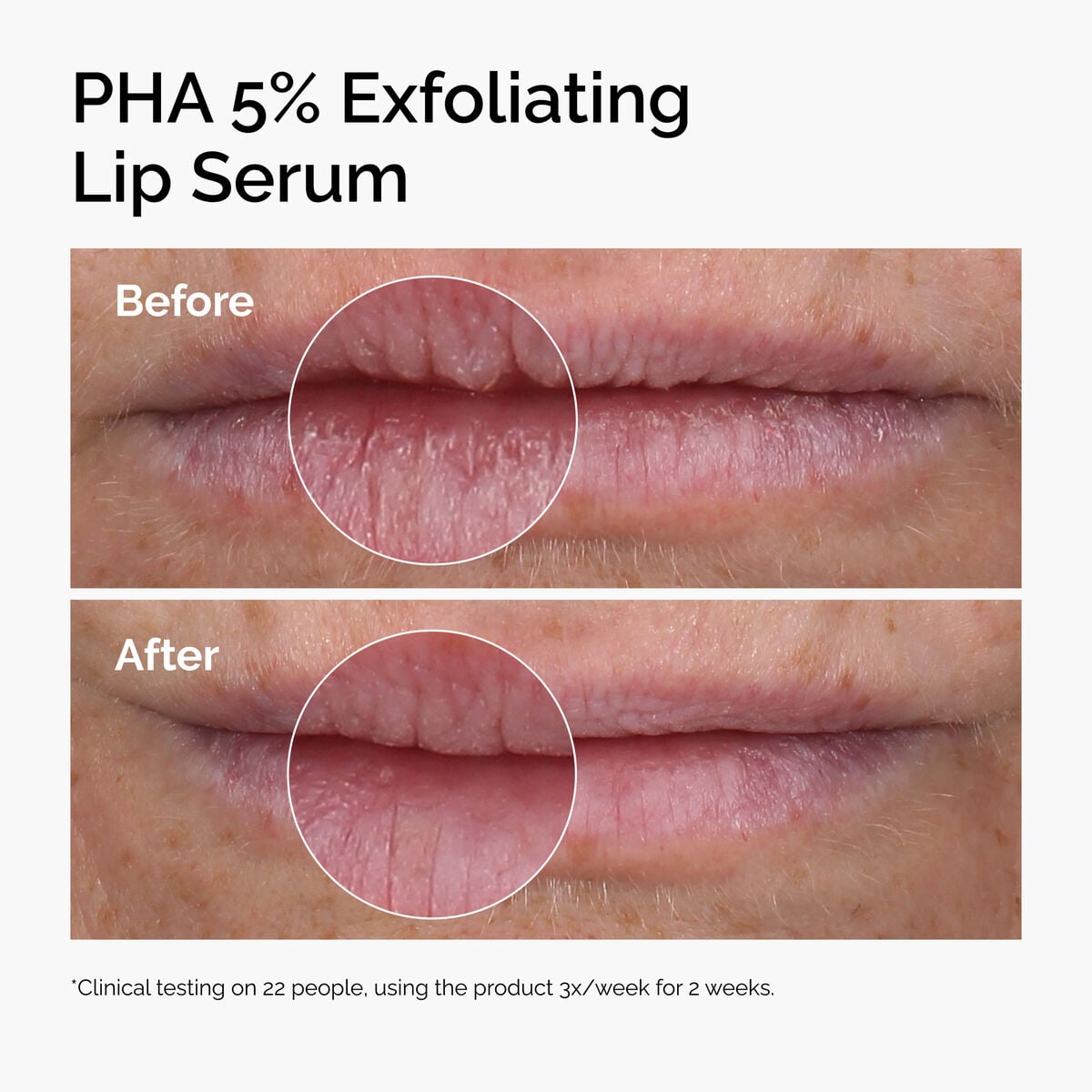 pha-5-exfoliating-lip-serum-u3 ord-pha-5pct-lip-exfoliating-serum-before-after.jpg